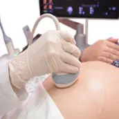 A-Z Obstetrics Ultrasound Guide