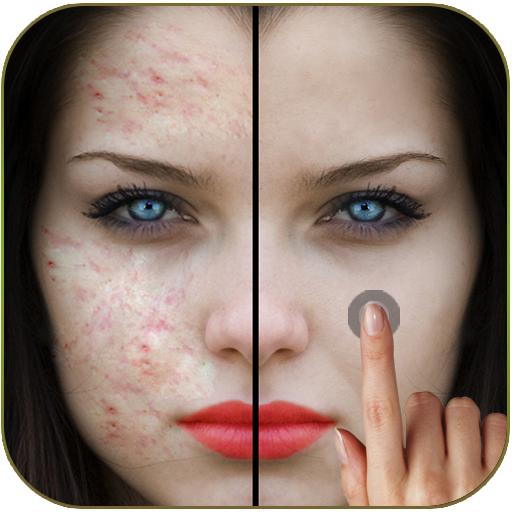 Pimples removing photo editing