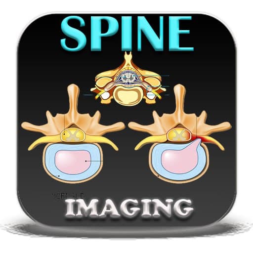 Spine Diagnostic Radiology