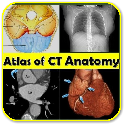 CT Scan Anatomy ATLAS - All in 1
