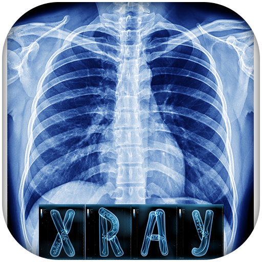 Chest X-ray interpretation