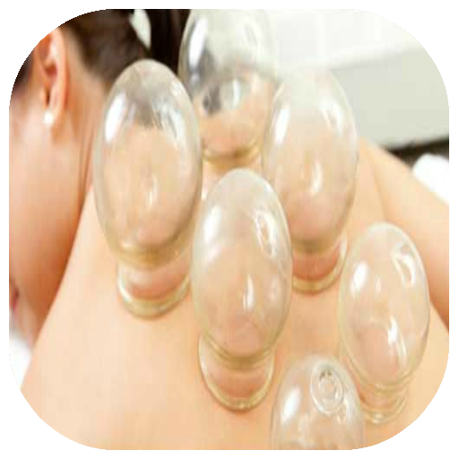 guide hijama