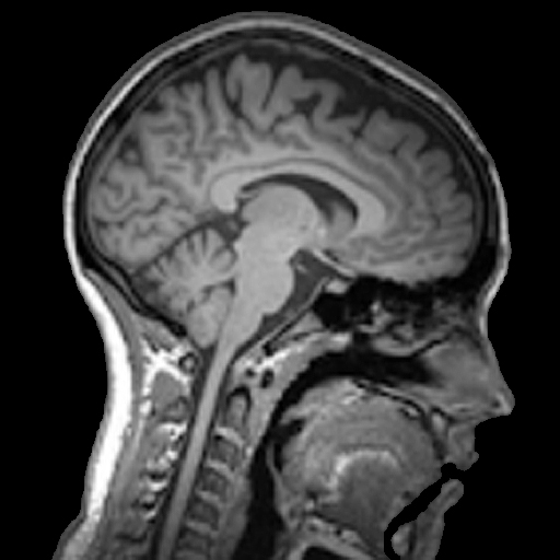 Understanding Medical Scans
