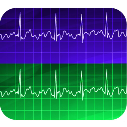 Electrocardiogram