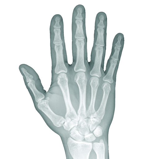 Real Xray - LED Emitting Scan