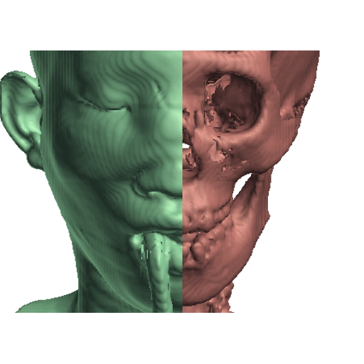 CT Scan Viewer 3D