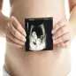 Ultrasound pregnancy guide