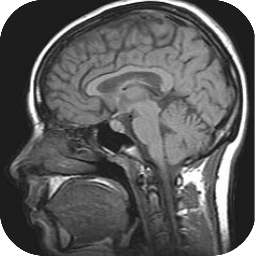 MRI Viewer