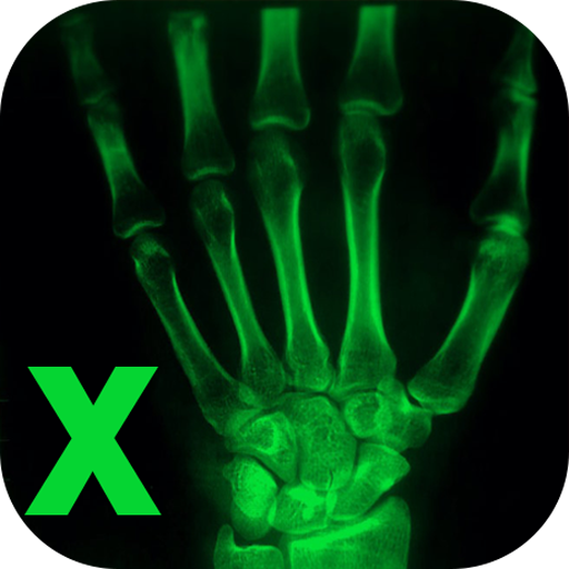 Xray Cam Real