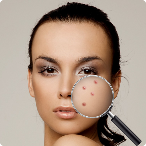 Pimple Remover, Eraser - Face Beauty Maker
