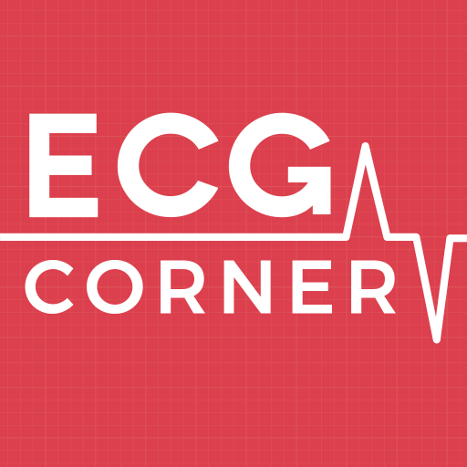 ECG Corner - Quiz for Practice