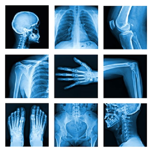 Medical X-Ray Interpretation w