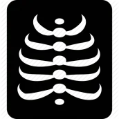 Chest XRay ABC