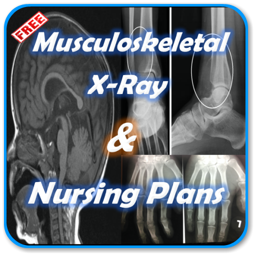 Musculoskeletal x-Ray and Nurs