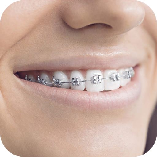 Teeth Braces Photo editor