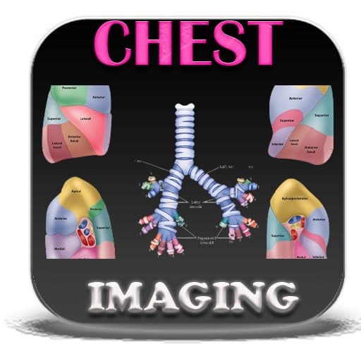 Chest Diagnostic Imaging