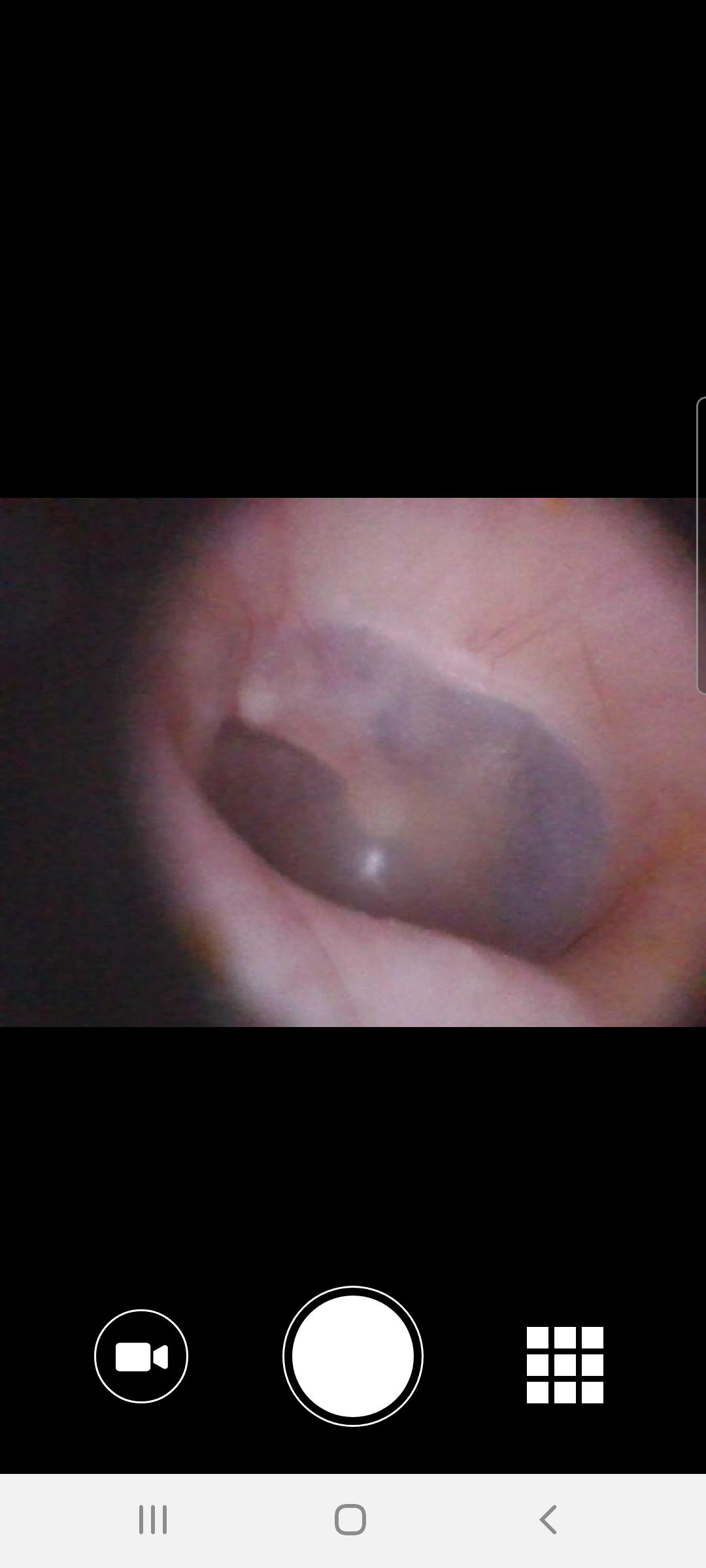 Download Blueberry Pediatrics Otoscope android on PC