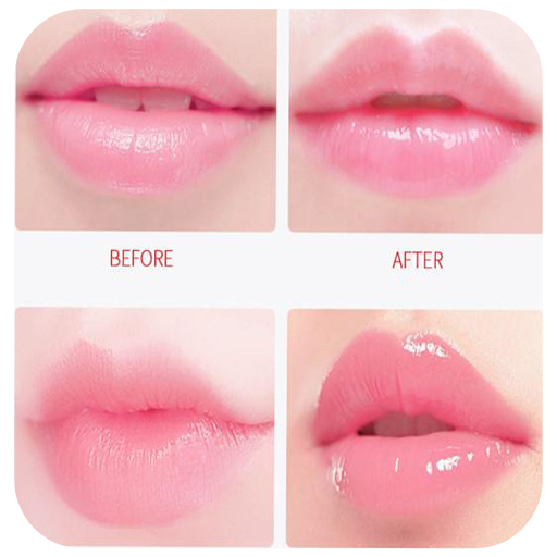 Natural Pink Lips Remedies
