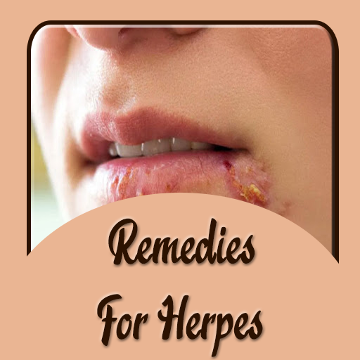 Remedies for Herpes