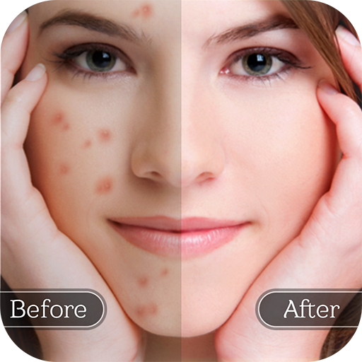 Face Blemish Remover - ผิวเรีย