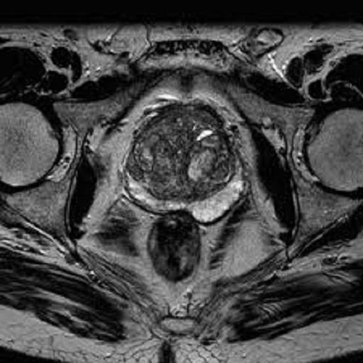 Magnetic Resonance Positioning