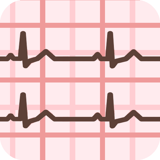 ECG Guide