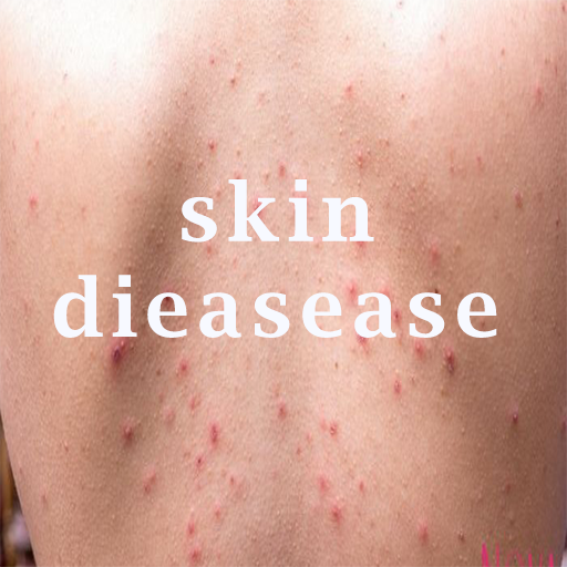 All skin diseases