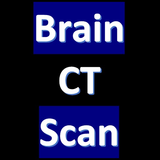 CT Scan of Brain