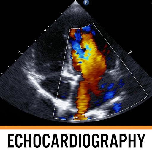 Echocardiography