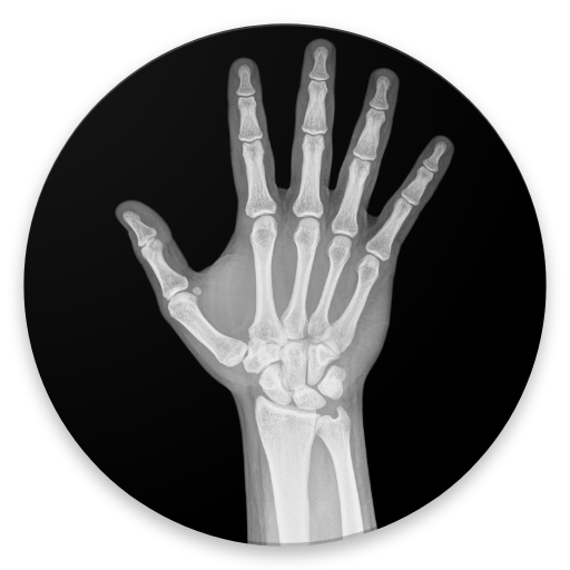 Bone age