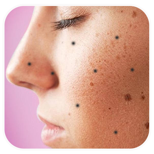 Get Rid Dark Spots On Face
