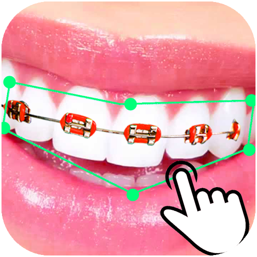 Trình chỉnh sửa ảnh của Braces