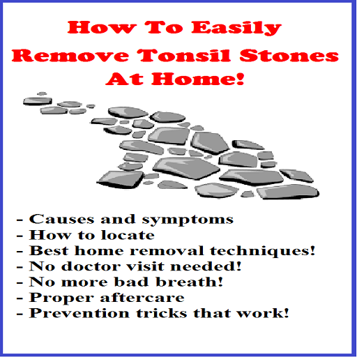 How To Remove Tonsil Stones