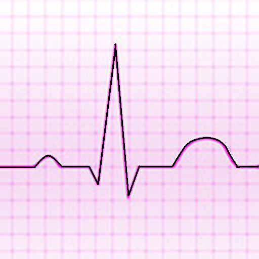 Electrocardiograma ECG Tipos