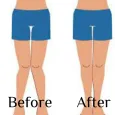 Legs straightening exercises