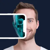 Body scanner x ray : xray app