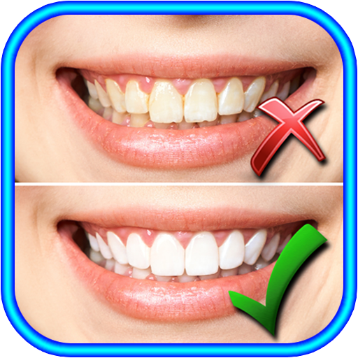 How to Whiten Teeth at home