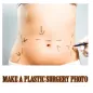 Make a plastic surgery body