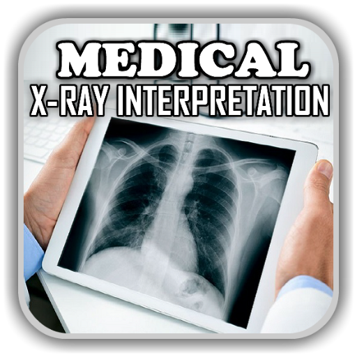 X-Ray Interpretation & Medical Chest X Ray Cases