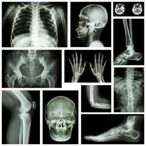 musculoskeletal x-ray interpretation GUIDE