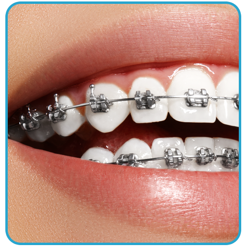 Braces Photo Editor - Beauty e